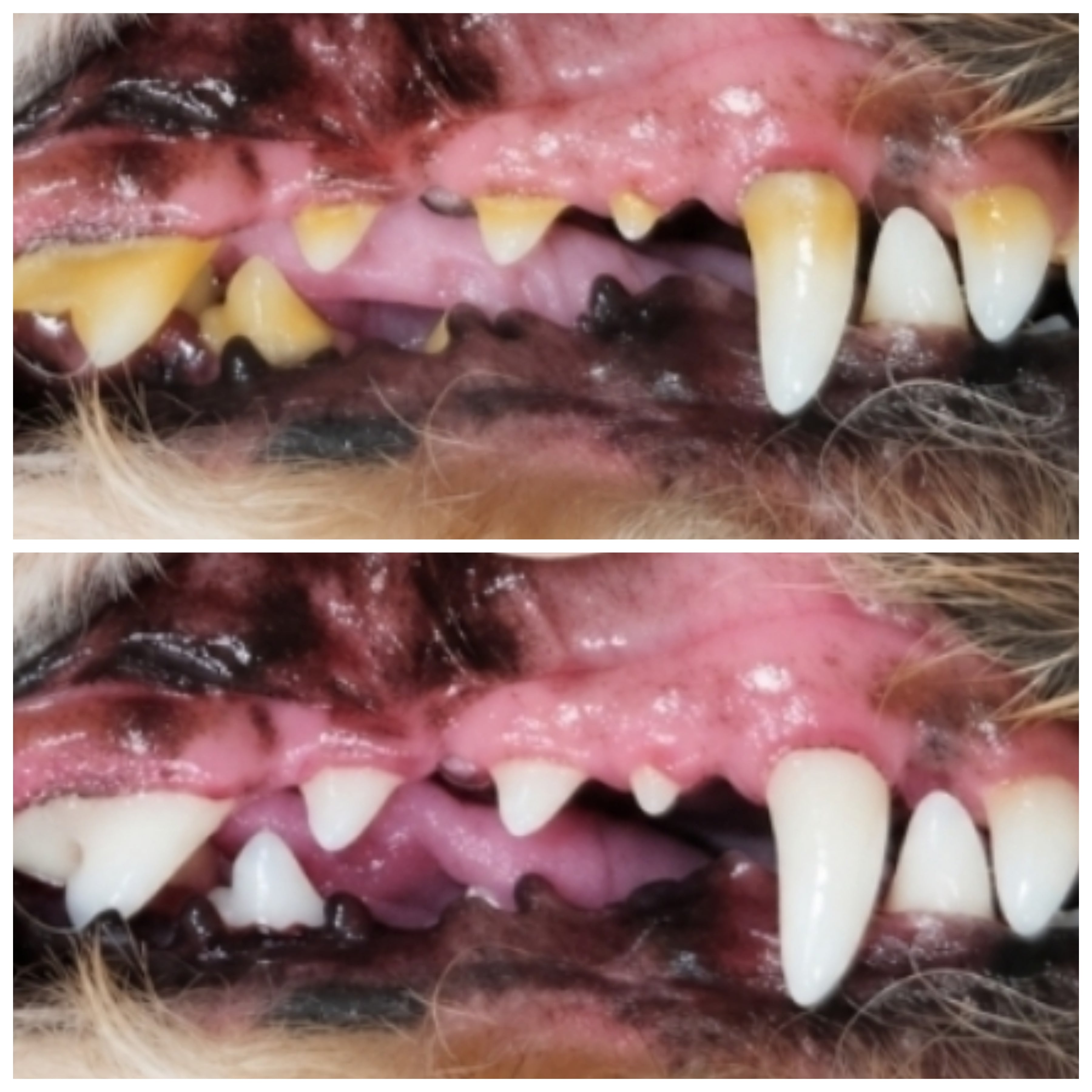 Tartart build up on teeth